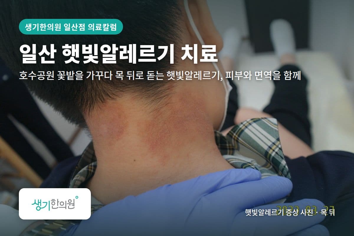 목 뒤 햇빛알레르기 증상 사진과 문구 「일산 햇빛알레르기 치료, 호수공원 꽃밭을 가꾸다 목 뒤로 돋는 햇빛알레르기, 피부와 면역을 함께 · 생기한의원 일산점」